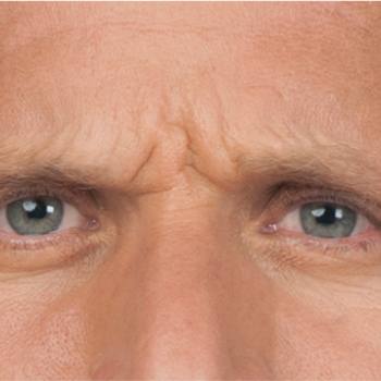 Before and After Eclipse Pen Frown Lines Male