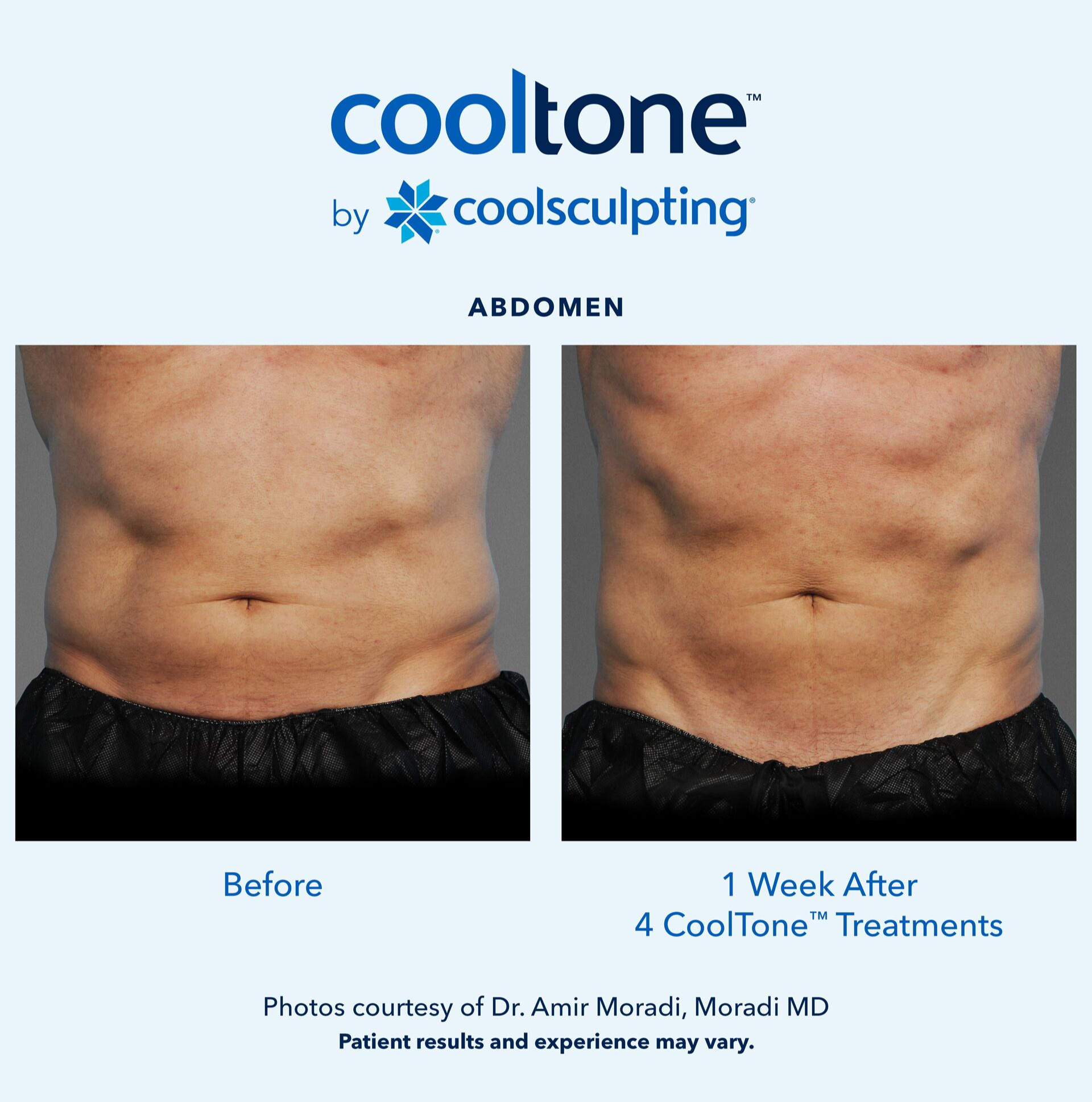 Patient Before & After