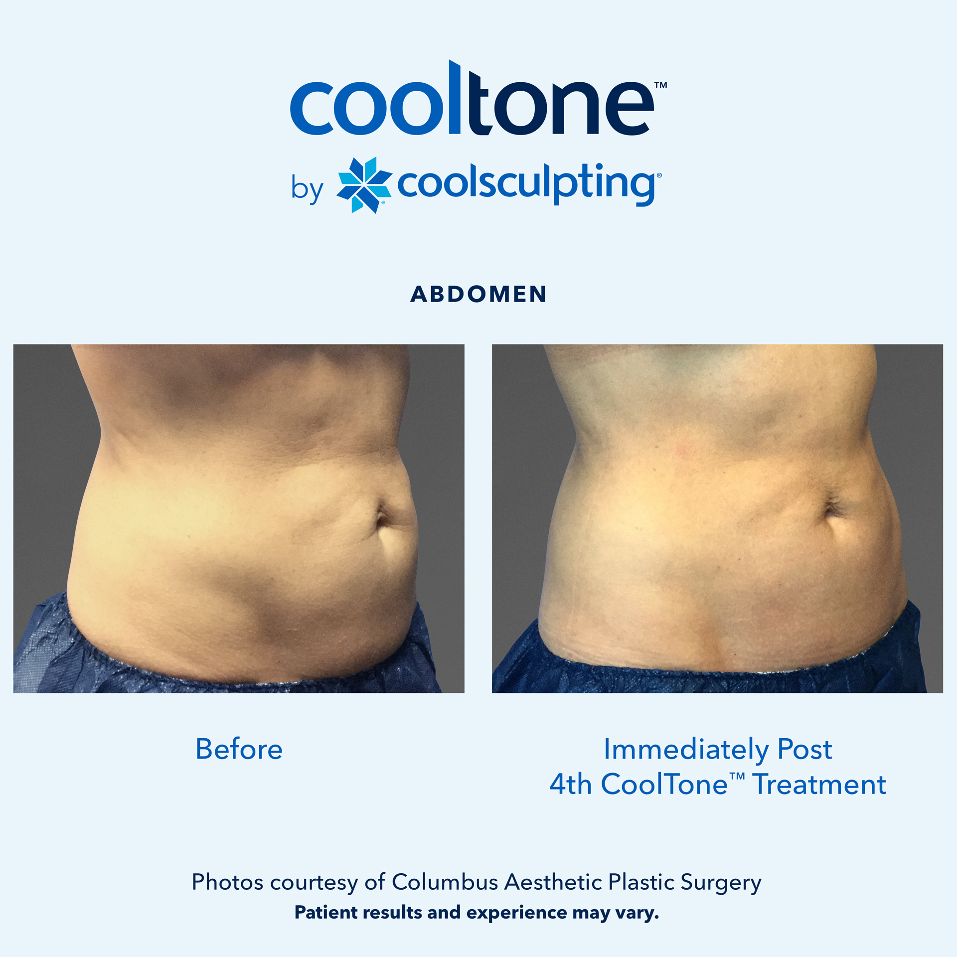 Patient Before & After
