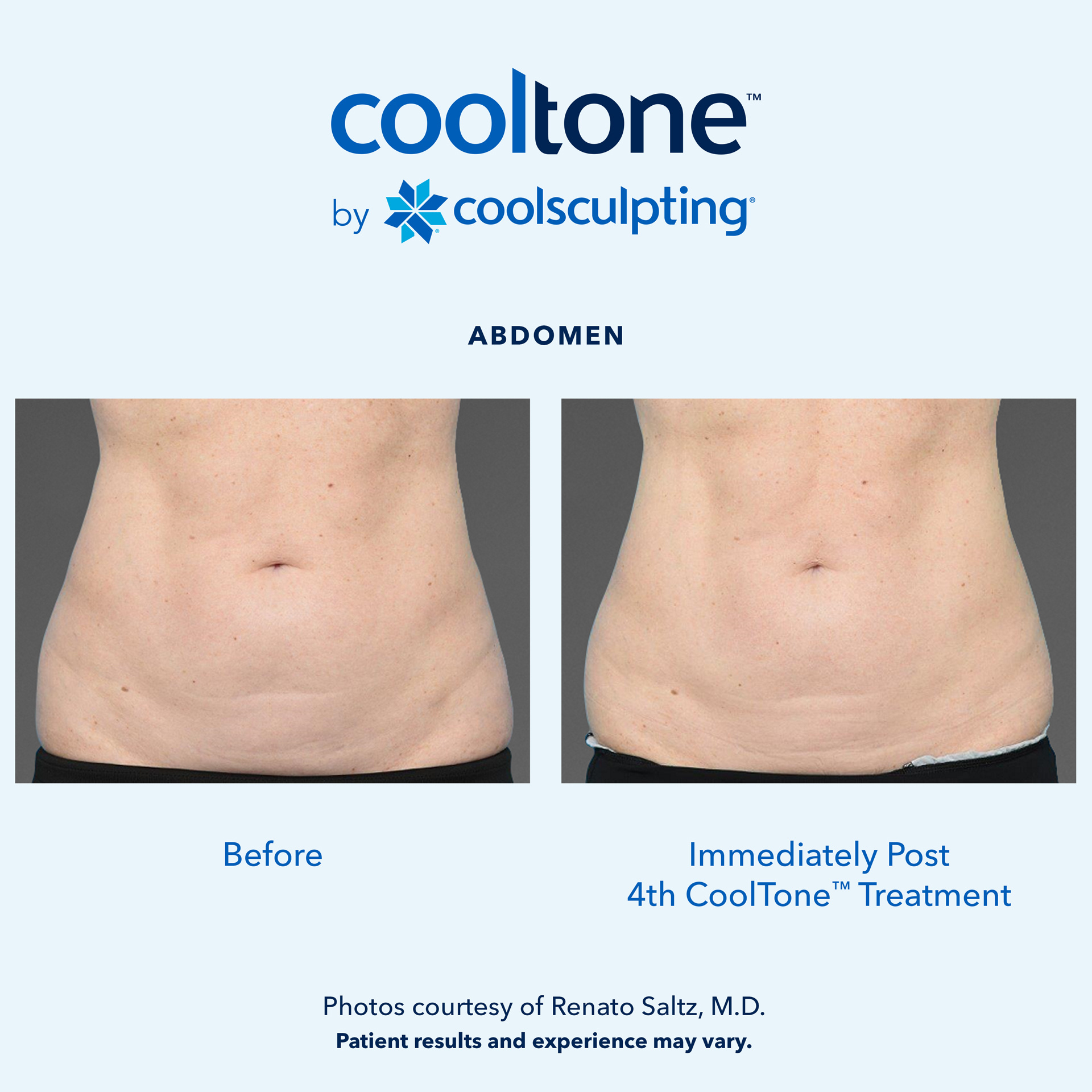 Patient Before & After