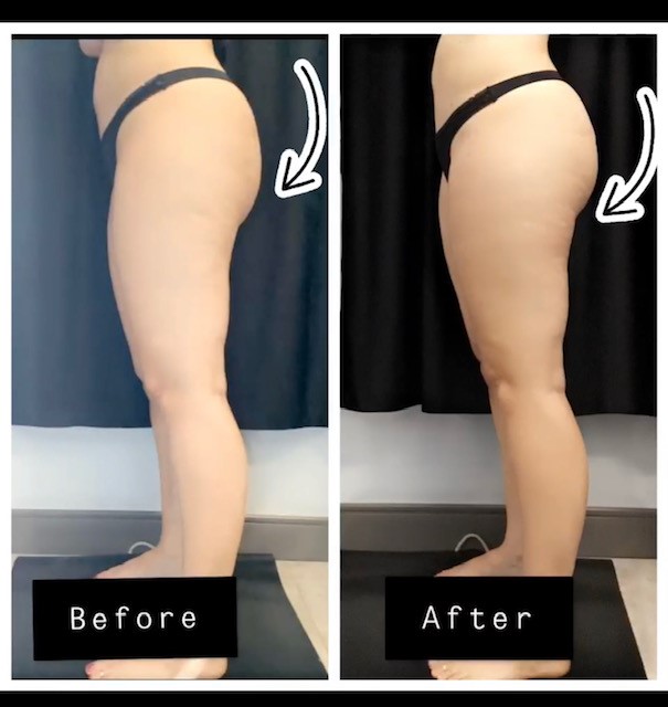 Patient Before & After